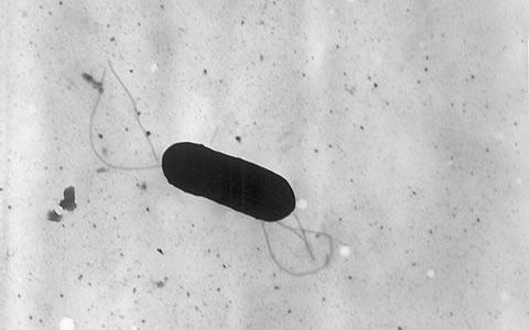 Listeria Monocytogenes en Chile, 2013 